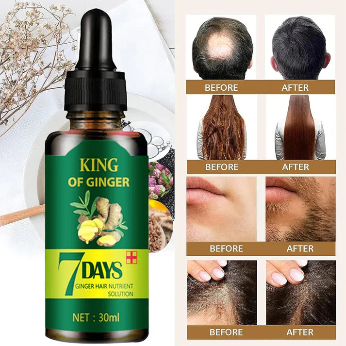 COMPRA 1 Y LLÉVATE 2 🚨GRAN LANZAMIENTO⚡️ - SERUM JENGIBRE ANTI CAIDA Y CRECIMIENTO ACELERADO 7DAYS™