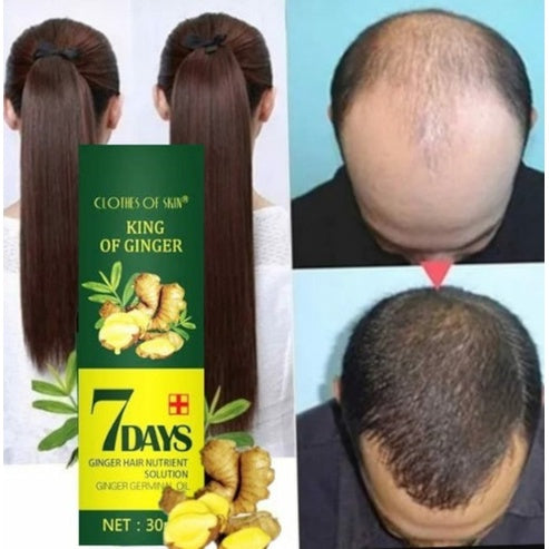 COMPRA 1 Y LLÉVATE 2 🚨GRAN LANZAMIENTO⚡️ - SERUM JENGIBRE ANTI CAIDA Y CRECIMIENTO ACELERADO 7DAYS™